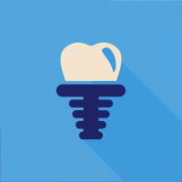 Δόντι με εμφύτευμα